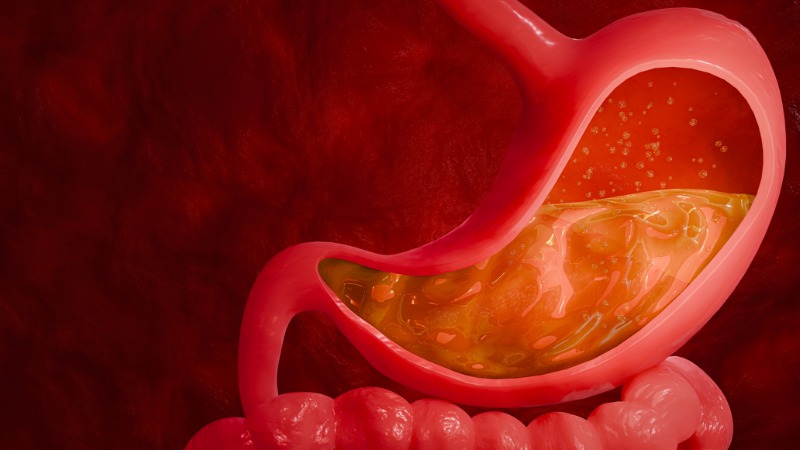reflux-gastro-oesophagien-acide